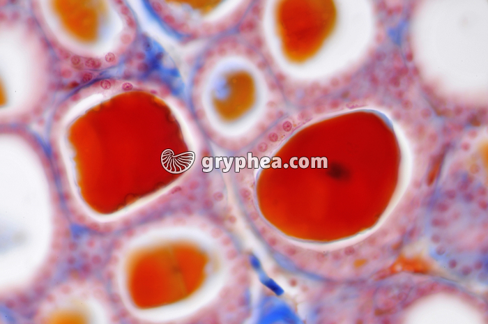 Thyroïde x160 - gryphea.com